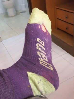 A pair of purple socks with holes in them